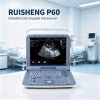 Échographe Doppler Couleur Portable RUISHENG P60, Écran 15 Pouces, Appareil Médical pour Hôpital, Clinique, Abdomen, Cardiaque, Obstétrique/Gynécologie