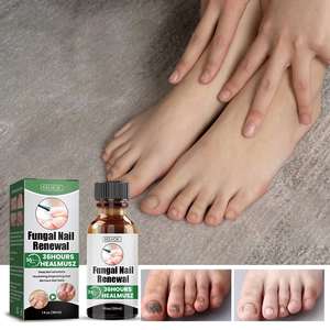EELHOE Vente en gros OEM 30ML Sérum Renouvellement des Ongles Anti-Fongique Huile Apaisante Nourrissante Réparatrice Traitement des Mycoses des Ongles - Product Image 5
