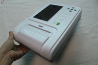Espirómetro portátil para la prueba de función pulmonar con corrección automática BTPS y operación con pantalla táctil para chequeos de salud comunitarios
