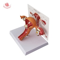 Modèle d'utérus, modèle anatomique, organes reproducteurs féminins, anatomie pathologique, modèle humain, sciences médicales