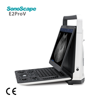 Ecógrafo Doppler Color Portátil SonoScape E2 ProV, Escáner de Ultrasonido para Veterinaria, Hospitales y Clínicas de Animales