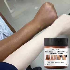 Logotipo personalizado Joelhos escuros e cotovelos Strong Whitening Creme Orgânico Rosto Pescoço Mão Branqueamento Creme Para Mancha Escura Pele Preta