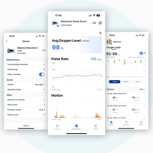 Viatom babyo2 máu oxy SpO2 thăm dò bé vớ Nhà ngủ ngưng thở thử nghiệm Đo Oxy với máy ảnh xung Đo Oxy - Product Image 6