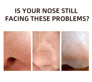 Patchs hydrocolloïdes imperméables pour le nez, élimination des points noirs, patchs pour le visage, éliminateur de points noirs, acné - Product Image 3