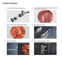 Système de caméra endoscopique portable Full HD IKEDA YKD-9101H 1/2.3'' CMOS