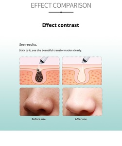 Waterproof ABS Electric Blackhead Remover Nose Pore <b>Cleaner</b> Acne Small <b>Bubble</b> Facial Cleansing Device - Product Image 3