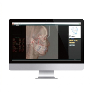 Imagerie <span class=keywords><strong>dentaire</strong></span> numérique 4-en-1 CBCT M2 FoV : Tomographie par faisceau conique, Tomographie par ordinateur à intelligence artificielle, Radiographie <span class=keywords><strong>panoramique</strong></span> 3D <span class=keywords><strong>et</strong></span> Imagerie céphalométrique - Product Image 6