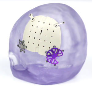 Plaque de titane médicale CANWELL pour la fixation de la plaque de crâne Plaque d'interconnexion de flocons de neige Types de plaques orthopédiques Plaque crânienne - Product Image 1