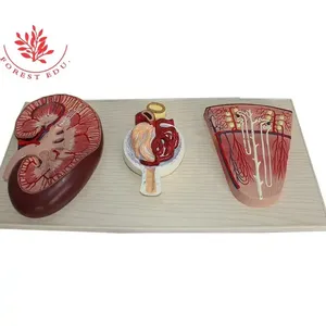 Modello anatomico di plastica umana rene, nefrone, anatomia dei Glomeruli renali modello di insegnamento di scienza medica - Product Image 1