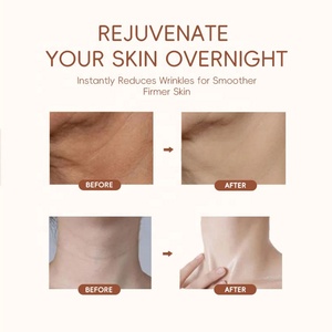 सिलिकॉन विरोधी झुर्रियां पैच फेस केयर लिंगेरी एक्सेसरीज पुनः प्रयोज्य ठीक लाइनों को हटाने के लिए - Product Image 6