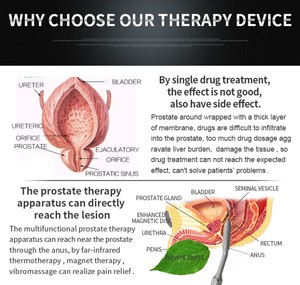Di alta qualità prostata massager della prostata anale stimolatore <span class=keywords><strong>per</strong></span> gli uomini - Product Image 6