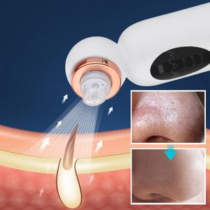 Petit aspirateur à bulles pour le soin de la peau à domicile, nettoyeur de pores pour le visage, forte puissance d'aspiration, appareil pour éliminer les points noirs - Product Image 2