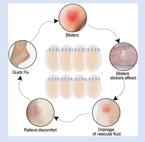 الأكثر مبيعًا خلع الملابس الطبية الغروانية المائية المعقمة رقيقة جدا لاصقة شفافة للحد من الاحتكاك في الأحذية - Product Image 2