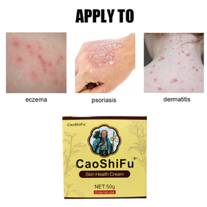 Crema Naturale a Base di Erbe 50g per la Cura della Pelle Dermatite Eczema Anti-prurito Urticaria <span class=keywords><strong>Desquamazione</strong></span> - Product Image 3
