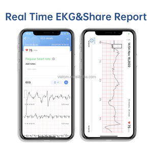 Viatom DuoEK S Single-lead Personal Ekg Monitor Instant Ecg Measurement and Analysis <strong>Connection</strong> Mobile Ecg Monitor - Product Image 4