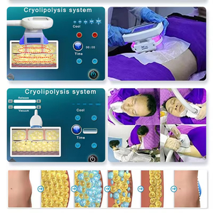Appareil de <span class=keywords><strong>Cryolipolyse</strong></span> et Cryothérapie pour l'Amincissement Corporel, Élimination des Graisses et Réduction des Vergetures – <span class=keywords><strong>Prix</strong></span> Compétitif - Product Image 3