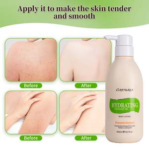 Lotion corporelle à l'huile de coco 300 ml, prévient la sécheresse, booste l'éclat de la peau, format voyage, en stock - Product Image 5