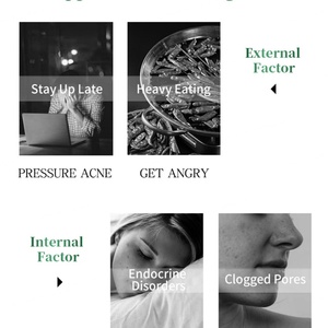 Sérum oligopeptidique pour la réparation des peaux abîmées et l'élimination de l'acné, marque privée OEM ODM - Product Image 3