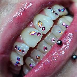 최고 공급업체 치아 보석 새로운 디자인 새로운 모양 금속 크리스탈 치아 보석 - Product Image 2