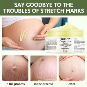 Crème Bio Anti-<span class=keywords><strong>Cellulite</strong></span> et Vergetures Marque Blanche, Crème Raffermissante et Éliminatrice de Vergetures pour le Ventre - Product Image 3