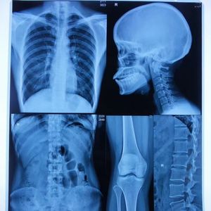 فيلم أشعة إكس أزرق ليزر نافث للحبر - Product Image 3