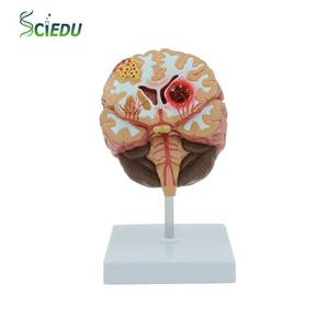 Modelo Anatómico del Cerebro Humano, Hemorragia Cerebral, Arteria Cerebral, Malformación Arteriovenosa Cerebral, Patología Cerebral, Material Didáctico para la Enseñanza de la Anatomía - Product Image 1