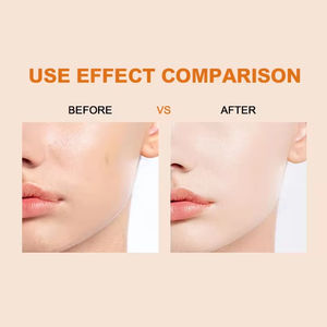 Das mit Niacin amid aufhellende <span class=keywords><strong>Serum</strong></span> mit Vitamin C-<span class=keywords><strong>Serum</strong></span> stärkt die Hydrate der Haut barriere mit Hyaluron säure - Product Image 3