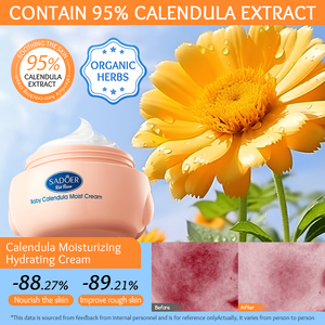 OEM SADOER <span class=keywords><strong>crema</strong></span> <span class=keywords><strong>idratante</strong></span> per bambini <span class=keywords><strong>Calendula</strong></span> biologica dolce <span class=keywords><strong>idratante</strong></span> per la cura della pelle sensibile <span class=keywords><strong>alla</strong></span> riparazione lenitiva <span class=keywords><strong>crema</strong></span> di bellezza per il viso del bambino - Product Image 2