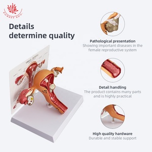 Modello utero organi riproduttivi femminili anatomia struttura patologica educazione anatomica - Product Image 4