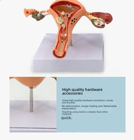 Sistema reproductivo femenino, herramienta de enseñanza de anatomía, modelo de útero humano con Vagina y ovarios, modelo de órgano de simulación patológica