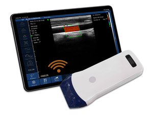 หัวตรวจอัลตราซาวนด์แบบไร้สาย USB 128 14 MHz ชนิด Linear Color Doppler สำหรับเครื่องอัลตราซาวนด์ ใช้ได้กับต่อมไทรอยด์ MSK M5P - Product Image 3