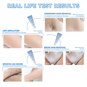 Крем для депиляции West Month: безболезненное удаление волос для мужчин и женщин - Product Image 2