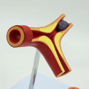 Model Pembelajaran arteri SCIEDU Model pengajaran sumber daya gray Anatomy manusia Model penyakit arteri koroner - Product Image 4