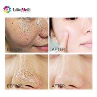 Fabriek Groothandel Fruit Zuur Essence Porie Krimpend Gezicht Hydraterende Verhelderende Whitening Vitamine C Serum