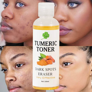 Tonique MOOYAM au curcuma pour les taches brunes et l'acné 100 ml Luxe pour tous les types de peau Élimine les taches et les imperfections - Product Image 4