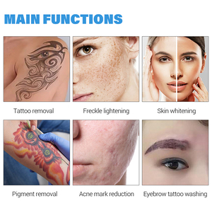 เครื่องล้างหน้าแบบพกพา กำจัดสิวเสี้ยน เครื่องลบรอยสัก - Product Image 4