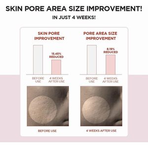 7.1โทนเนอร์ SKIN1004ใสสำหรับผิวบอบบางและเคราตินขนาด210มล. จากมาดากัสการ์ - Product Image 4