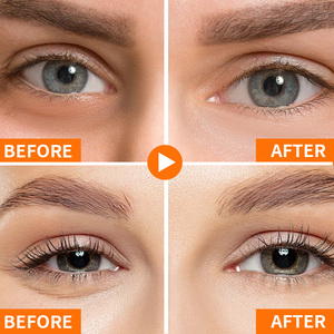 Patchs Hydrogel PDRN OEM <span class=keywords><strong>Anti</strong></span>-<span class=keywords><strong>Cernes</strong></span> Sous les Yeux à la Caféine, Niacinamide, Adénosine et Alpha Arbutine – 60 unités - Product Image 6