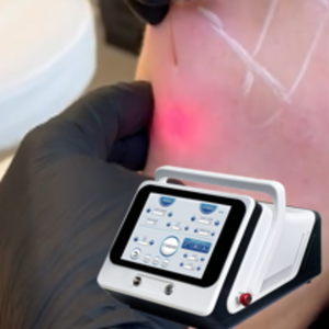 <span class=keywords><strong>Prix</strong></span> promotionnel Endolifting Fiberlift 1470nm, lifting du visage sans chirurgie, liposuccion, dissolution des graisses, resserrement de la peau, <span class=keywords><strong>laser</strong></span> - Product Image 6