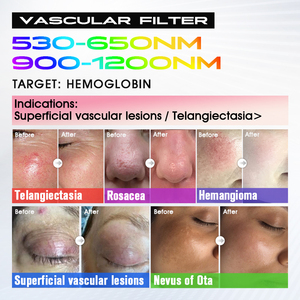 Máquina Antienvejecimiento BBL <span class=keywords><strong>Plus</strong></span> de Nivel Médico, Dispositivo Reafirmante Antiarrugas para Cuello, Rostro y Cuerpo Completo - Product Image 4
