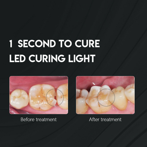 New Arrival Dental <b>LED</b> Curing <b>Light</b> With 6 Models Wireless 1 Sce <b>Led</b> Curing With Caries Detection 385-515nm Dentist Equipment - Product Image 4