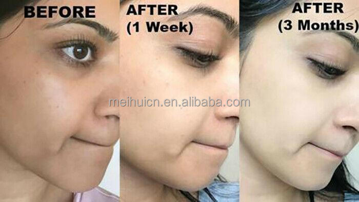 OEM Whitening Brightening Moisturizer Exfoliator Face Serum Face Scrub Face Oil Strawberry Skin Care Gift Set