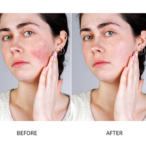 Nettoyant visage en crème douce Riginas avec acide hyaluronique, non irritant et rafraîchissant pour les peaux sensibles, pour hommes - Product Image 6