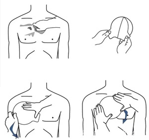 Sello Torácico Compacto Ventilado para Exteriores con 4 Orificios, Adhesivo y Estéril, Apósito para Heridas, para IFAK y Emergencias de Succión Torácica - Product Image 6
