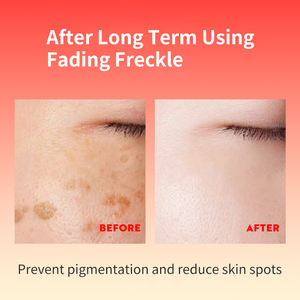 Crema y Loción Facial Anti-Manchas con Nicotinamida TWG, Eficaz para Eliminar Manchas, Blanquear, Desvanecer Manchas Oscuras y Anti-Pecas - Product Image 2