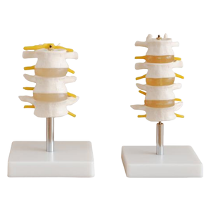 ADA <b>Medical</b> PVC <b>Model</b> Lumbar Set (3 Pcs) and Lumbar Set (4 Pcs) for Disease Demonstration <b>Medical</b> Teaching Tool - Product Image 1