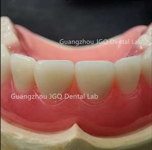 Las dentaduras postizas de boca completa personalizadas, los dientes acrílicos ofrecen una estabilidad mejorada para masticar, comer y hablar con un precio asequible - Product Image 6