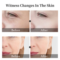 Sérum Visage 5-en-1 Marque Blanche : 30% Vitamine C, 10% Acide Hyaluronique, 5% Niacinamide, Sérum au Collagène pour Éclat et Anti-Rides