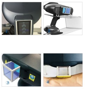 Lampu Terapi Sinar Matahari Terlaris untuk Depresi, Fototerapi UVB 308nm Sistem Excimer untuk Pengobatan Psoriasis dan Vitiligo - Product Image 2