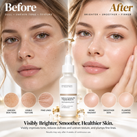 Sérum Visage Exfoliant Doux, Solution Tonifiante pour une Peau Nette, Élimination de l'Acné, Effets Blanchissants et Apaisants